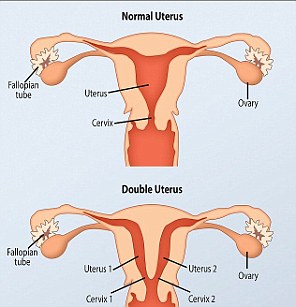 Woman with 2 vaginas pics