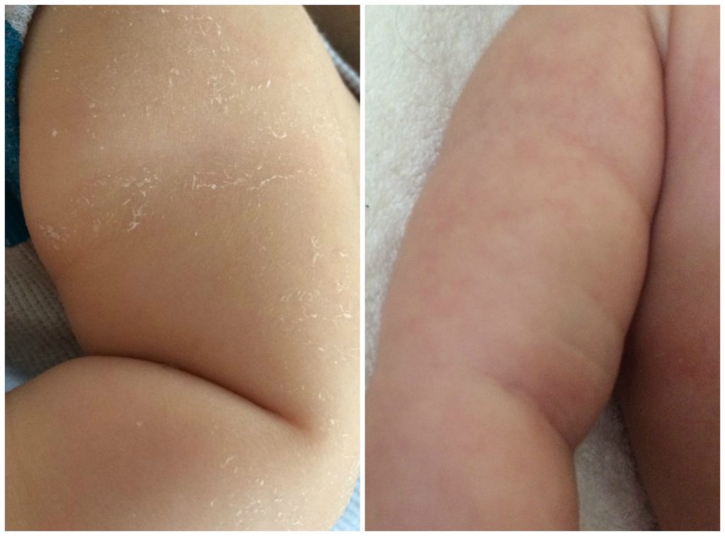 waterwipes-before-and-after
